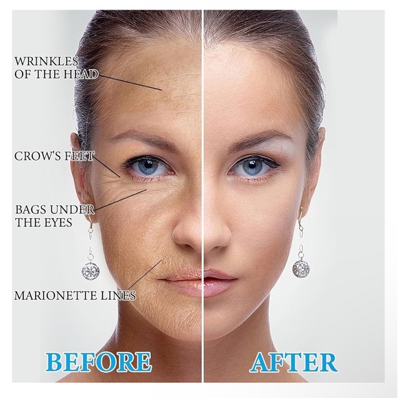 T-17: Lot of 4 Botox Stock Solution Facial Serum - Picture 3 of 7